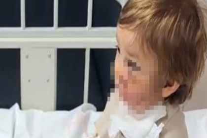 İki kardeşe saldıran pitbullun sahibi konuştu: "Koruma içgüdüsüyle saldırdı." | NTV Haber